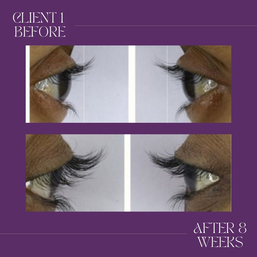 XXtraLash Eyelash Serum + GF - 3ml