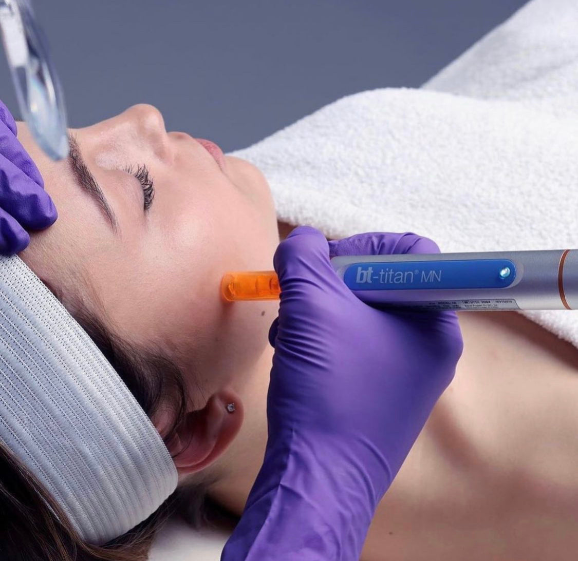 bt-titan® MN model AE +FREE AquaFuse Tech Peel 4oz + Nano Tip Cartridge 20 pack