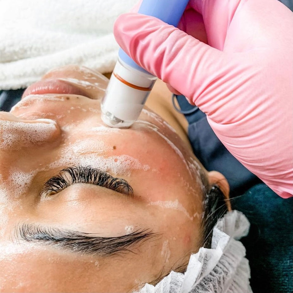 Bio Brasion Trinity Wet/Dry Microdermabrasion